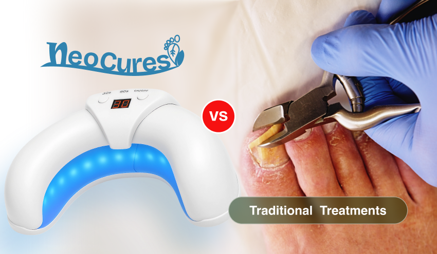 NeoCure™ vs. Traditional Nail Fungus Treatments