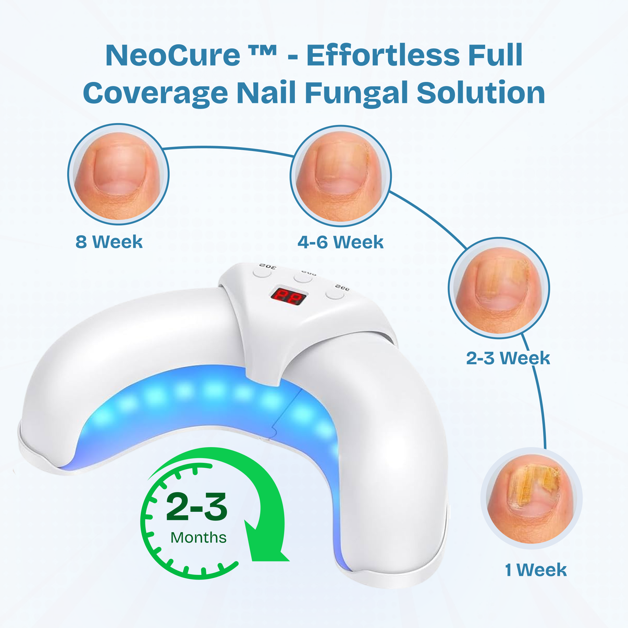 Flash Sale: 70% OFF Your Next NeoCure™ [Today Only]