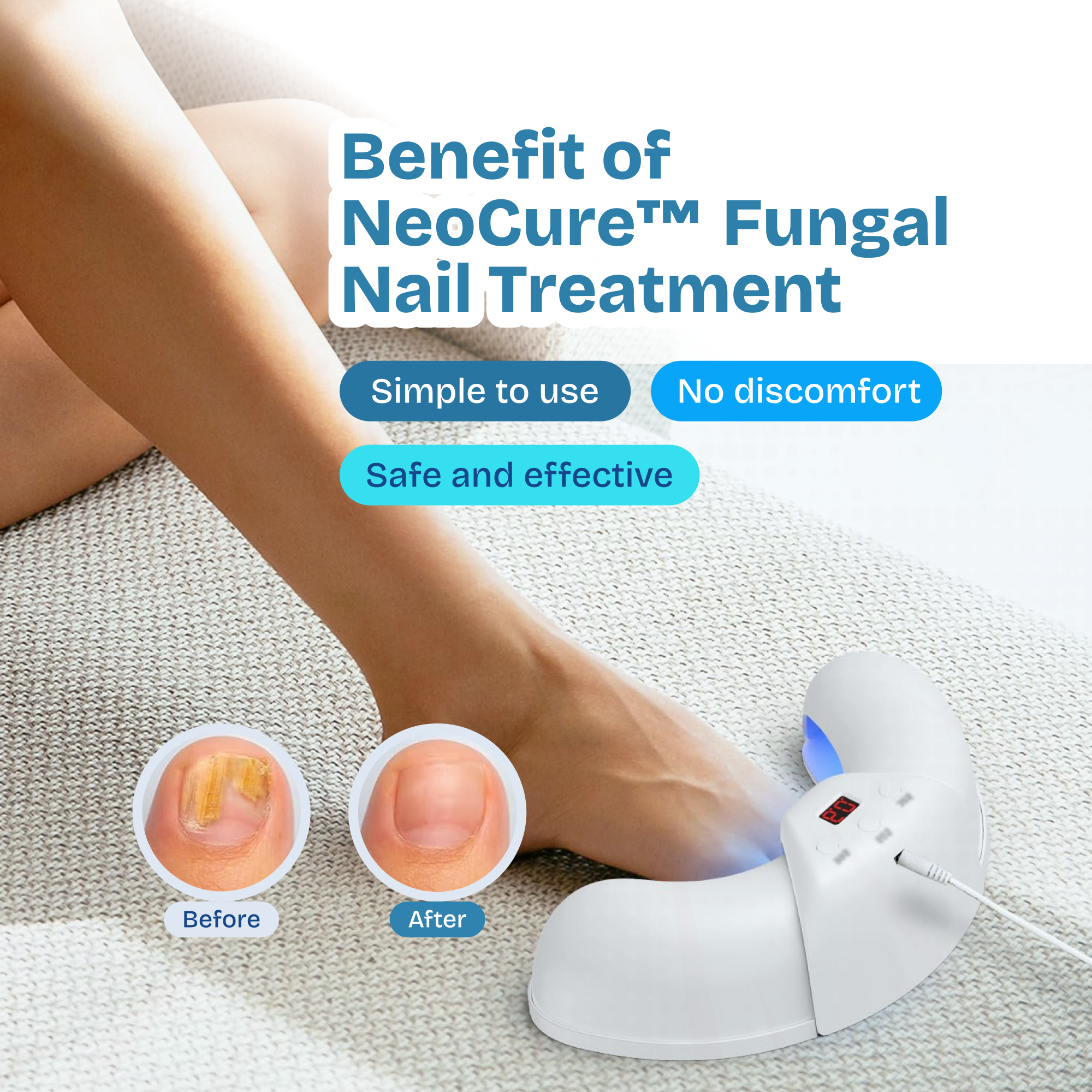 NeoCure™ - Nail Healing Device (50% OFF)